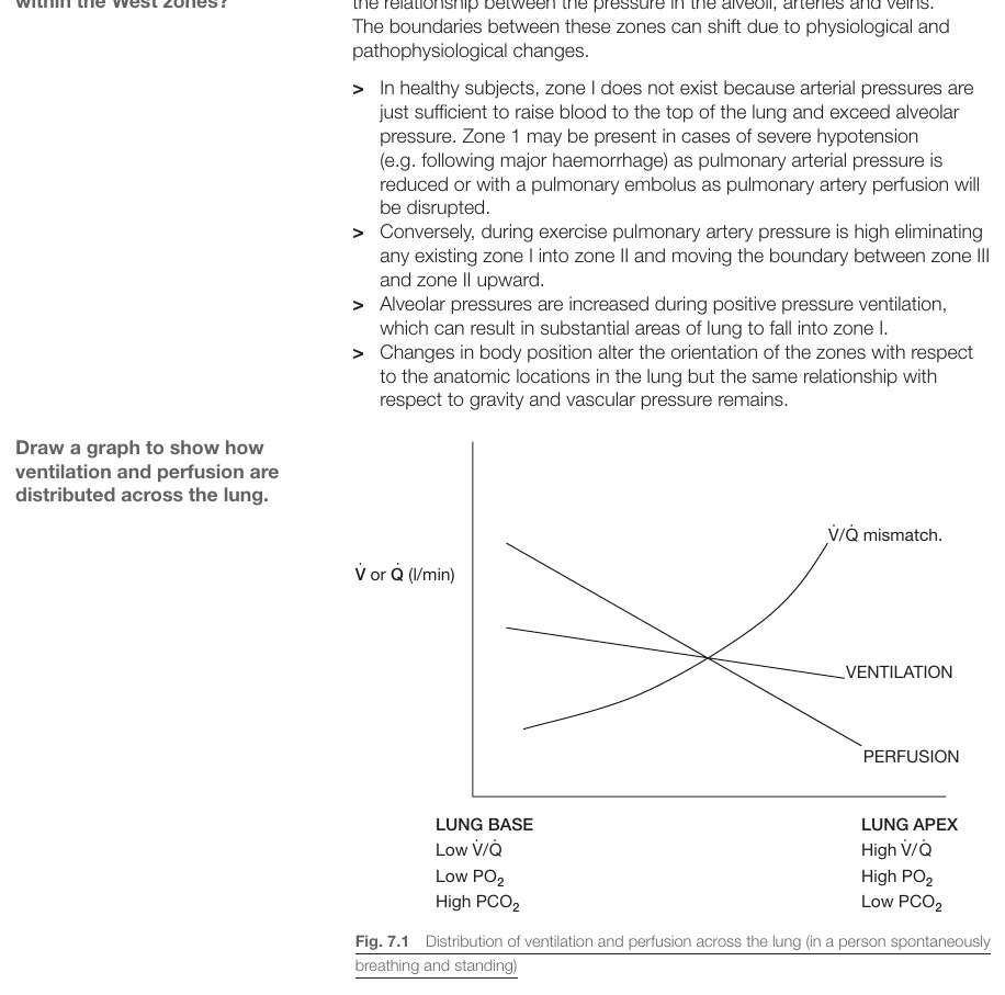 V/Q-mismatch och shunt-diagram med dead space, normalt och shunt