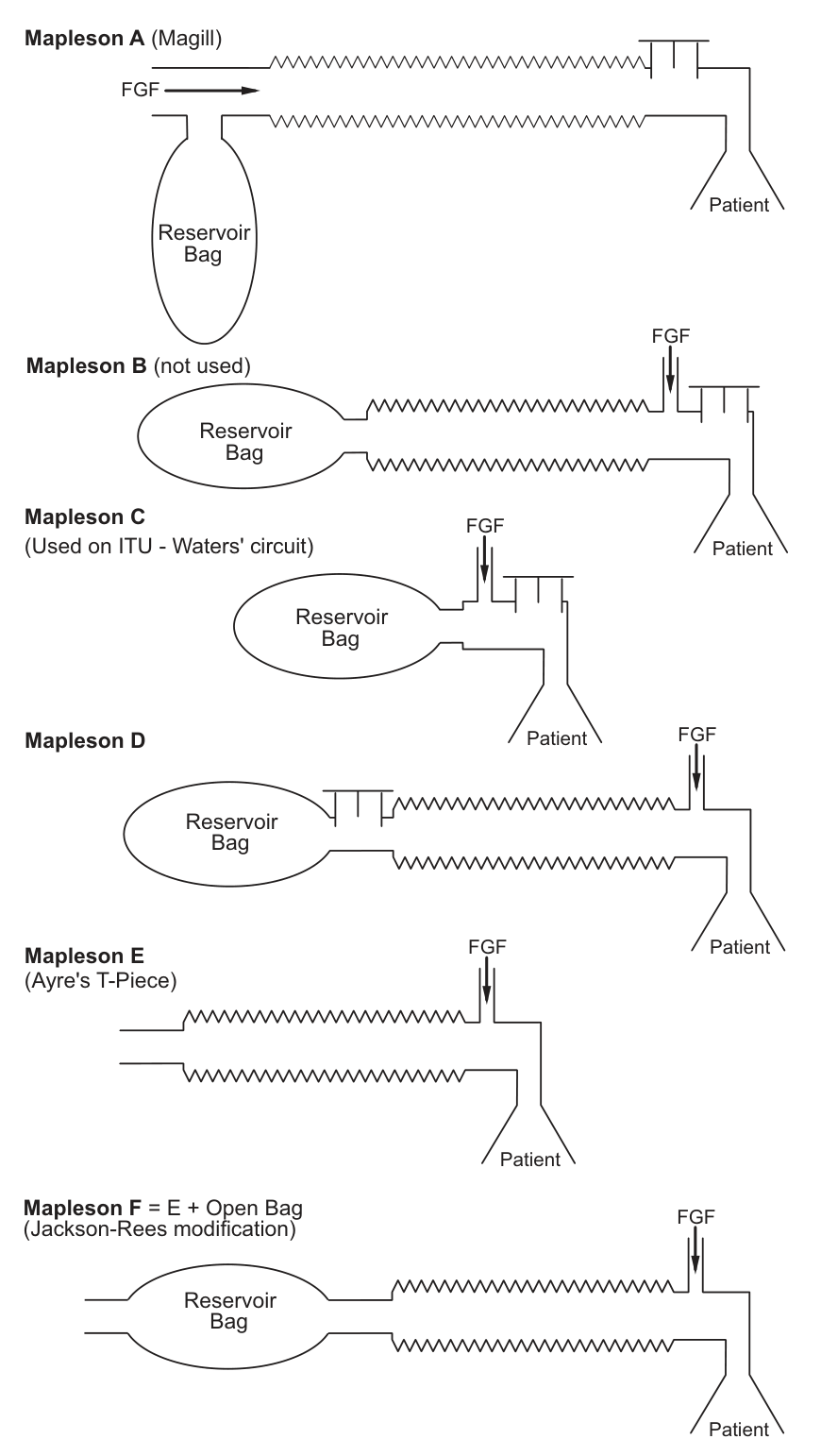Mapleson-klassificering (FRCA Fig 74.1).