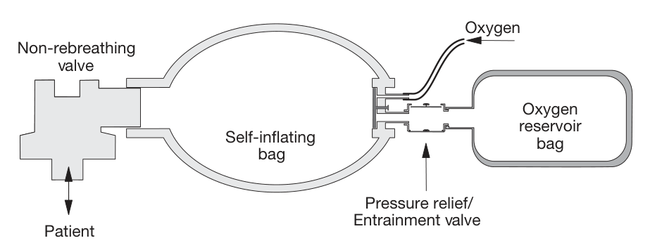 Självexpanderande påse med envägsventil (non-rebreathing) (FRCA Fig 75.1).