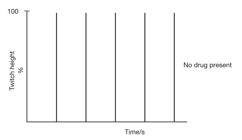 Single twitch utan blockad (FRCA Fig 78.1).