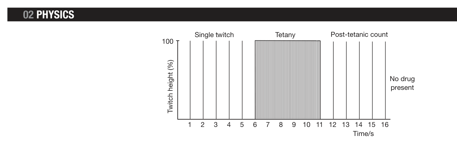 Double Burst Stimulation (FRCA Fig 78.6).