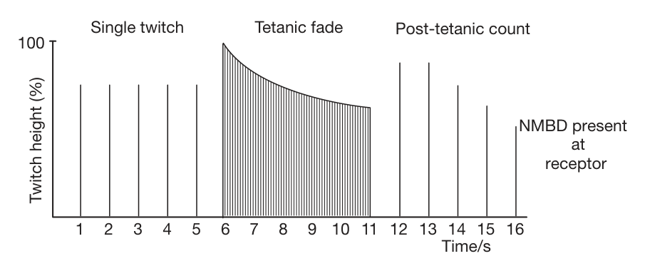 DBS med blockad (FRCA Fig 78.7).